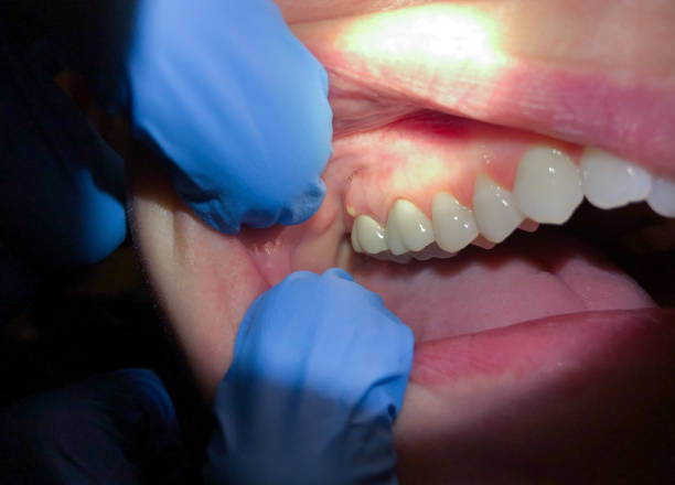Best Mobile Emergency Dentist in USA